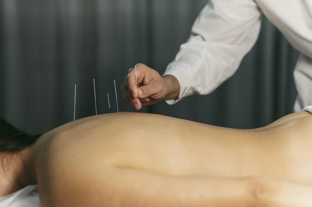Acupuncturist in Sittard